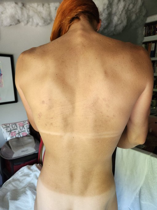 muffins ass, compliments of Me  My back,  compliments of a free tasting from a generous local Domme https://t