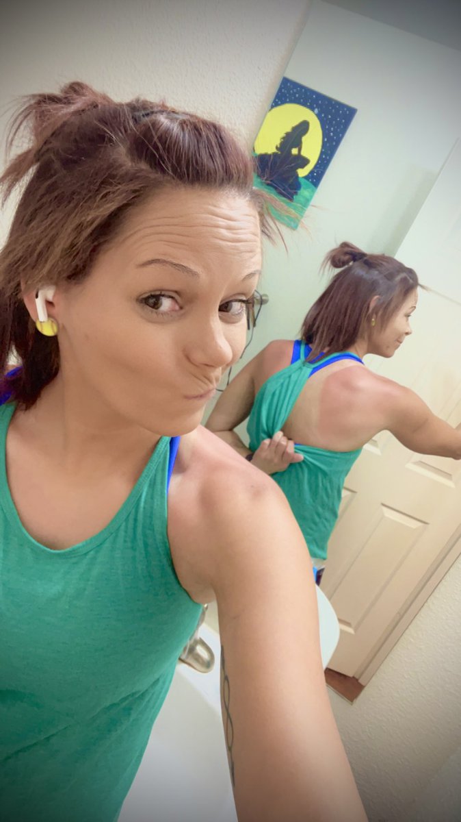 _Coach_Traci's tweet photo. Don't forget your sunscreen folks...or you will regret it...like me! 😂🤣🥎 This pic does not do this sunburn justice! #ForTheLoveOfTheGame #SacrificesIMakeForMyPlayers #ChochProblems https://t.co/D5bNlAmZAS