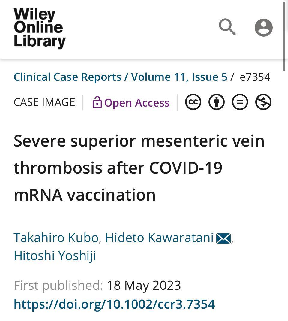 Trombosi grave della vena mesenterica superiore (SMV) dopo la 'vaccinazione' dell'mRNA COVID-19

Un caso di studio dal Giappone di un uomo sulla sessantina che lamentava dolore addominale 1 giorno dopo la 'vaccinazione' dell'mRNA Covid è stato scoperto 7 giorni dopo in ospedale