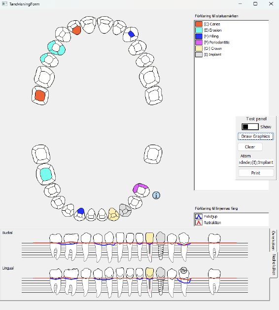 SciPasTips's tweet image. Dentists and dental assistants use dental charts to store the records of each patient’s dental health. Staffan Holmnäs presented an interactive version in their thesis, which was developed in #ObjectPascal with @EmbarcaderoTech #Delphi. theseus.fi/handle/10024/7…