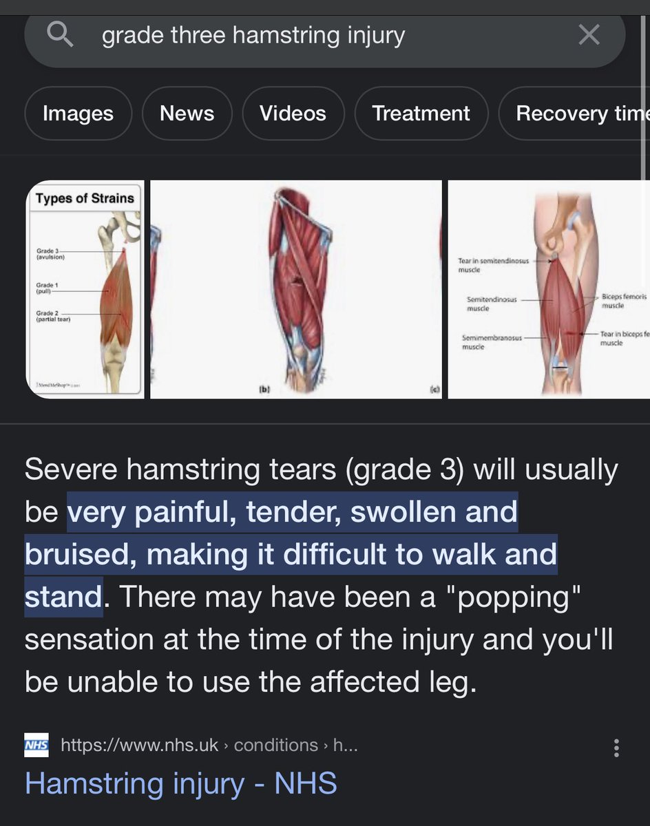 KingKevvs's tweet photo. “Faked his injury” … https://t.co/fPfEMfxaVd