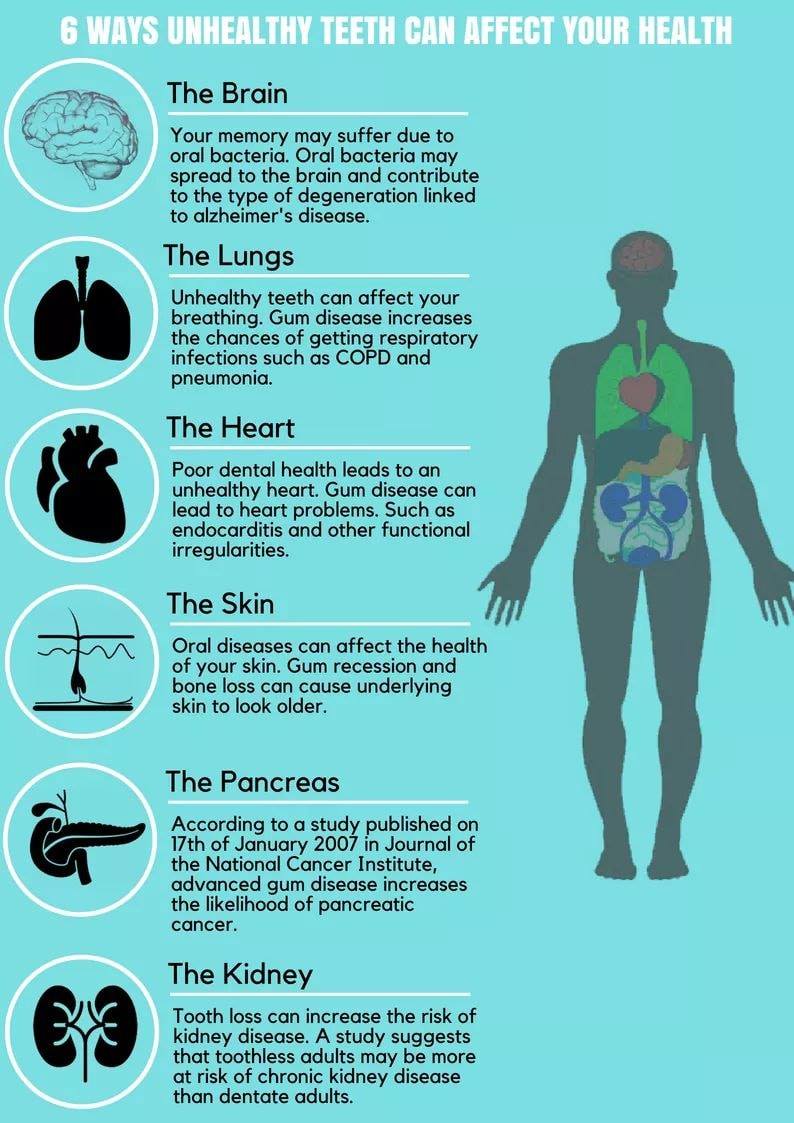 #Unhealthyteeth can cause various #healthissues. #Infographic