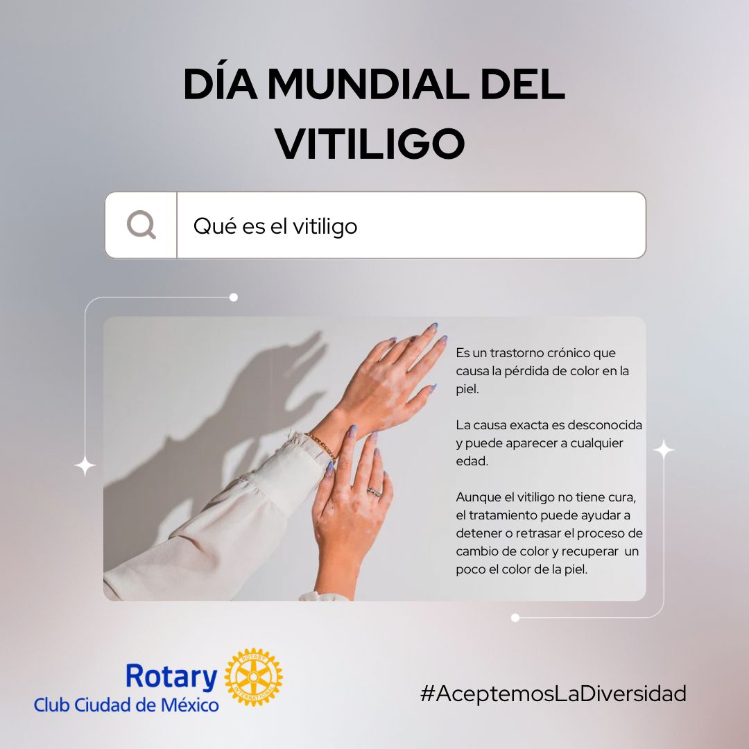 En el #DíaMundialDelVitiligo reflexionamos sobre lo importante que es conocer este padecimiento y ser incluyentes con quienes lo padecen #AceptemosLaDiversidad #Rotary #ClubRotarioCDMX