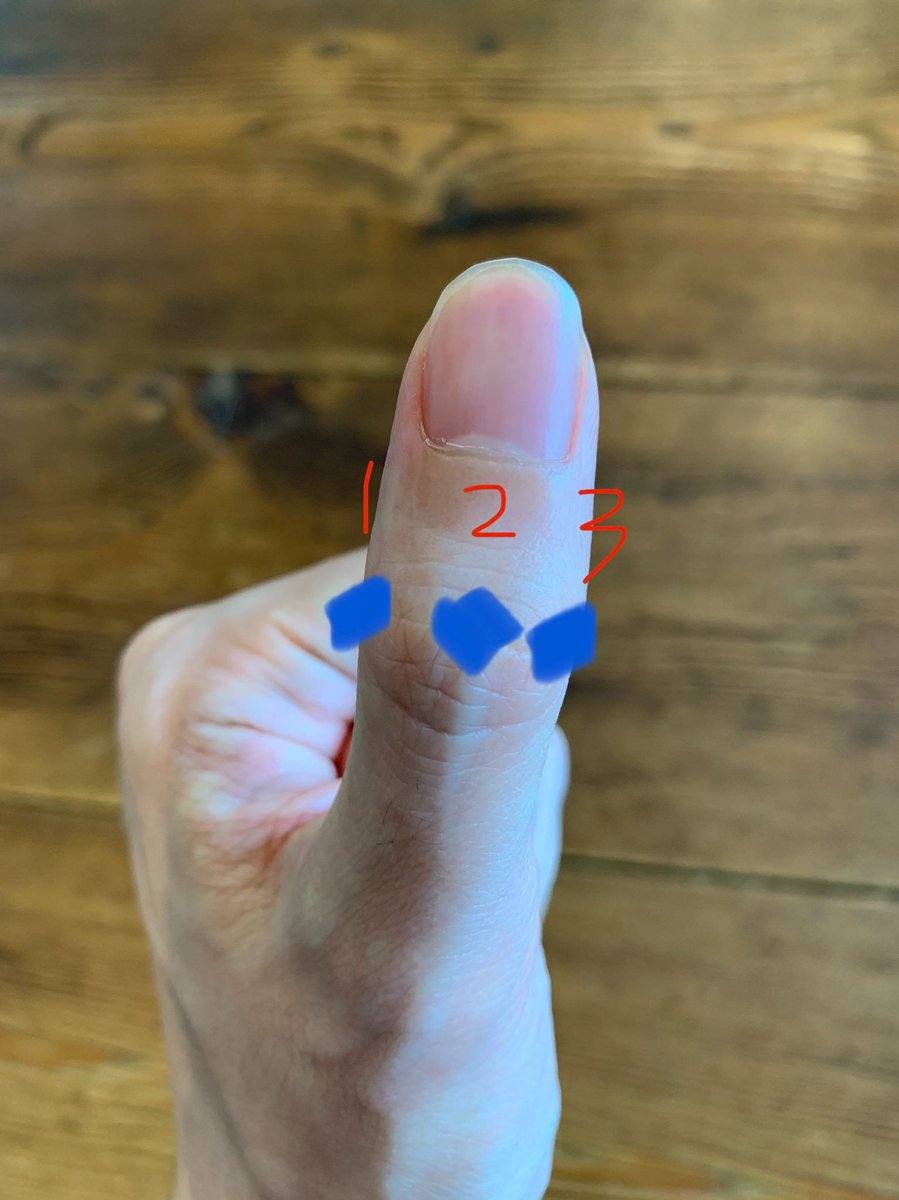 KochiMethod24's tweet photo. If you use your phone, computer or tabled devices, please try it
Press the pressure points 1, 2 and 3.

About sixty seconds on 1, 2 and 3 for each side.
Do this on both sides.

This pressure point helps to mitigate fatigue in the eyes. https://t.co/PNeX7LlwCn