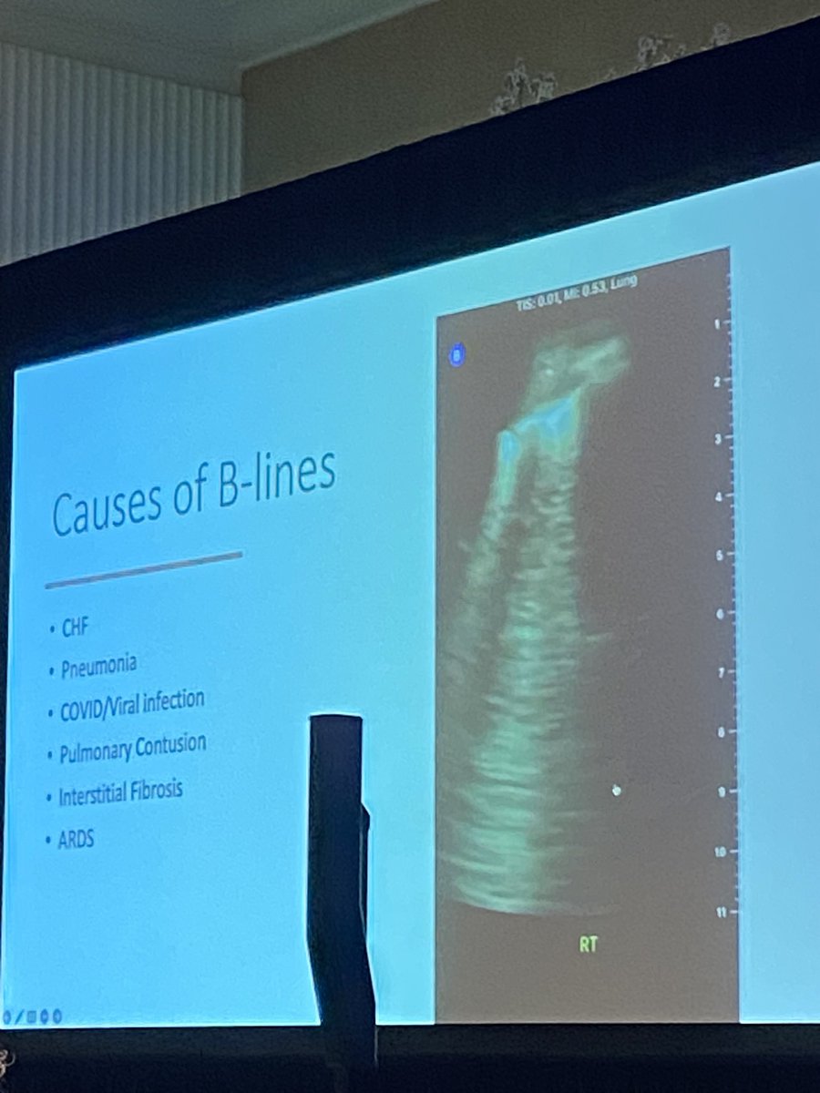 _SonoSara's tweet photo. Kicking off talks on Pulmonary Embolism, Dr Nova Panebianco @pennultrasound on lung ultrasound #ASE2023 https://t.co/K2gmoqq2zS