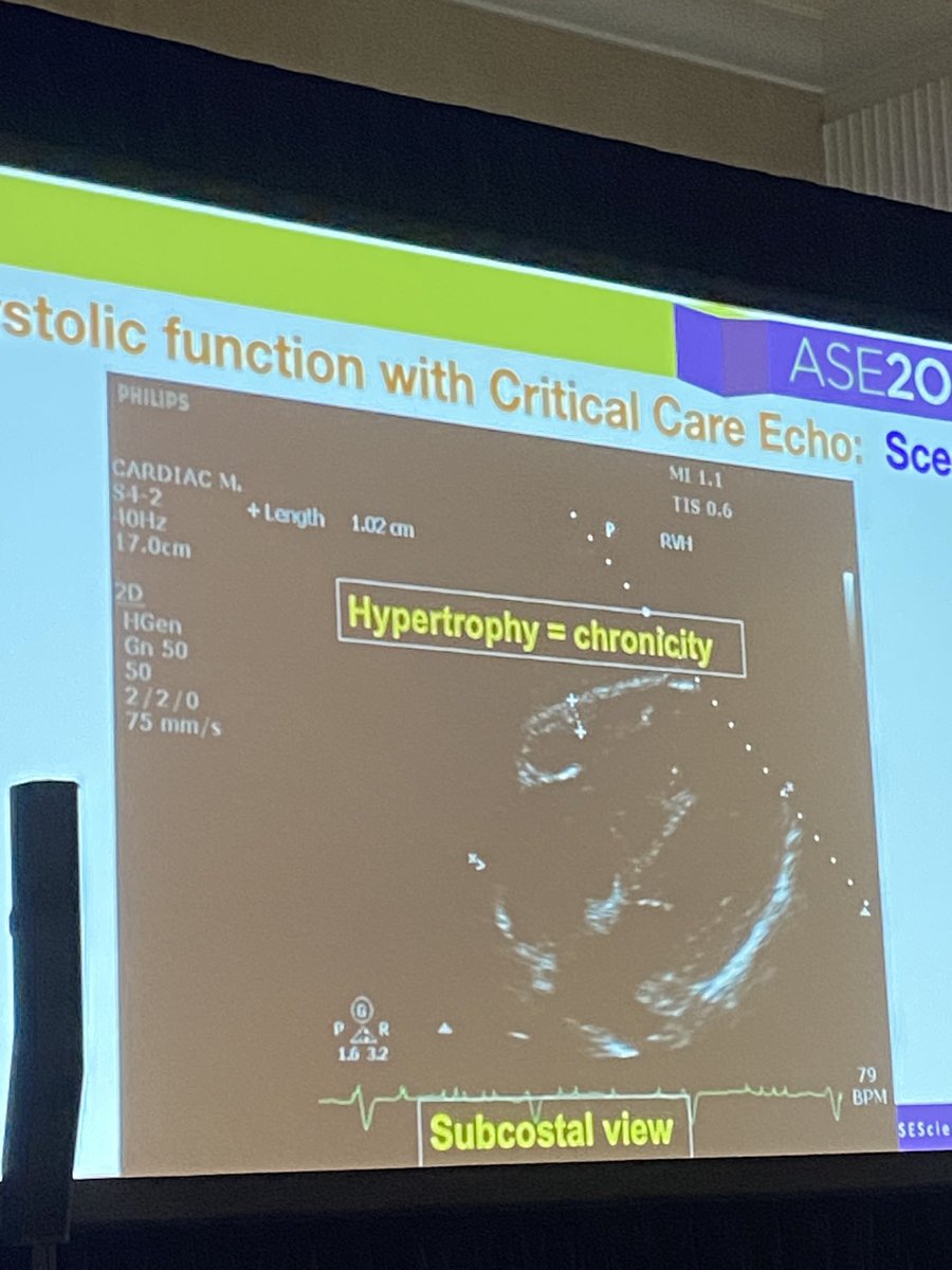 _SonoSara's tweet photo. Another great talk in the Pulmonary Embolism Series, evaluating RV function #ASE2023 by @Jose_Diaz_Gomez ! https://t.co/j2dPy6z2FN
