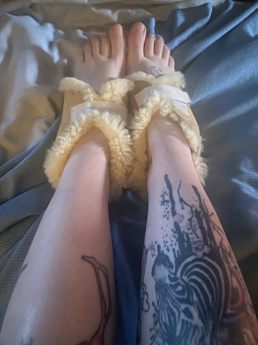 JustAddisonGrey's tweet photo. #heds shirt! Too hot to get dressed today..
Except for my wierd sheepskin heel boot things.. They stop them burning though! #neurological #wierdfeet #feet #toohot #blah 🥵 https://t.co/Fm9b91LqU8