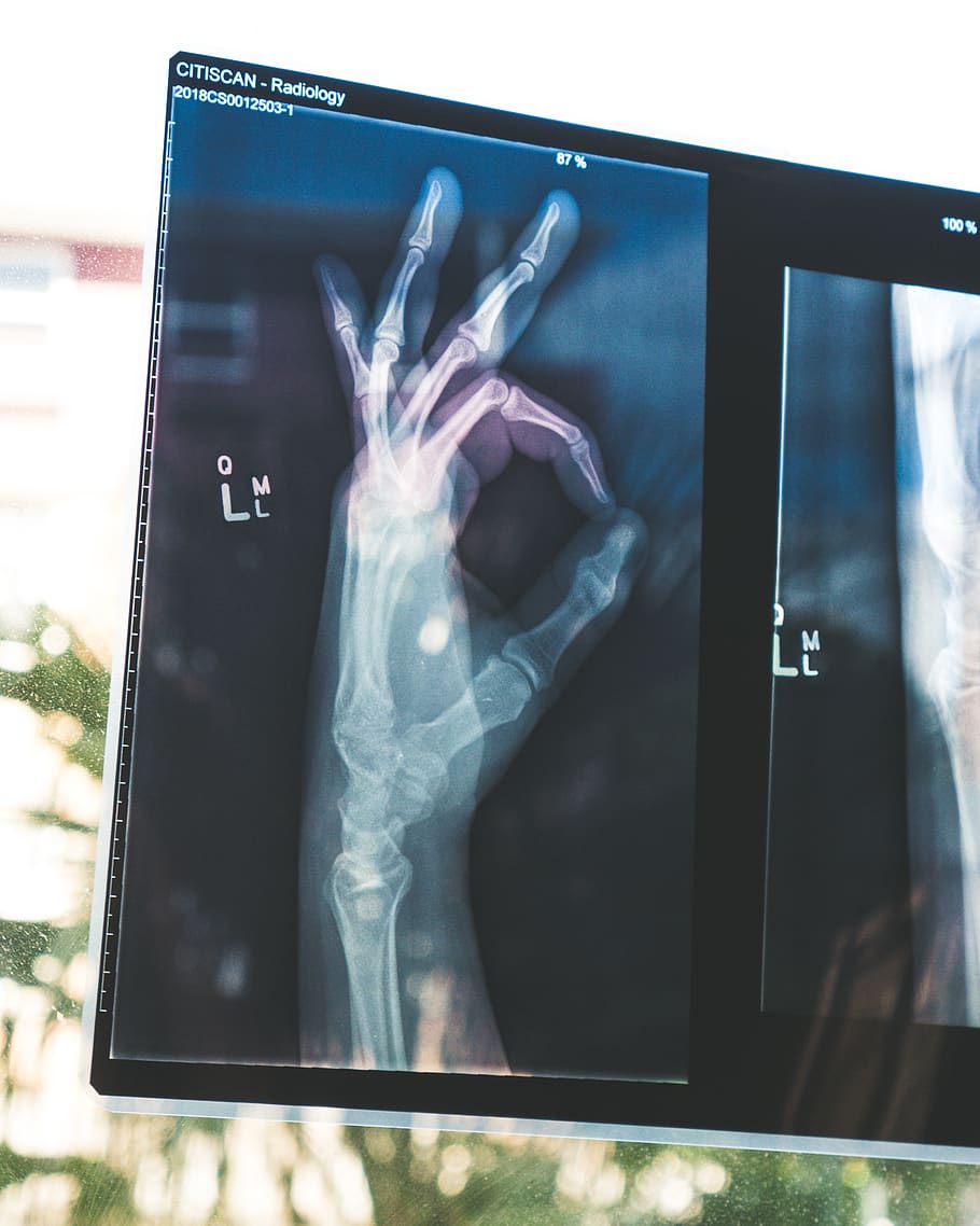 Are you interested in radiology? Do you want to gain transferable skills like leadership, organisation and public speaking?
Find a role to suit you at our AGM held at 18:00 on the 4th of July.
Join Zoom Meeting
uofglasgow.zoom.us/j/84351771057
