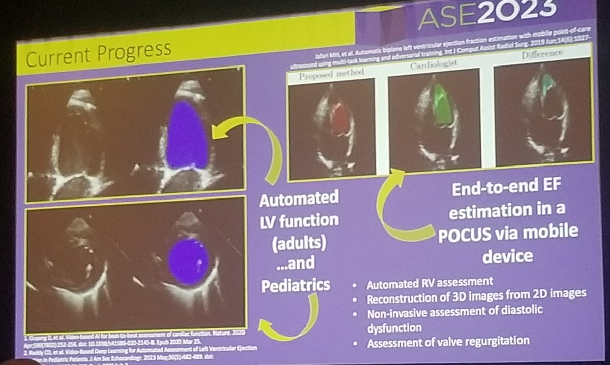 The future is coming (and in some ways already here). Charitha Reddy showing automated function assessment, even on #POCUS. #ASE2023 @ASE360