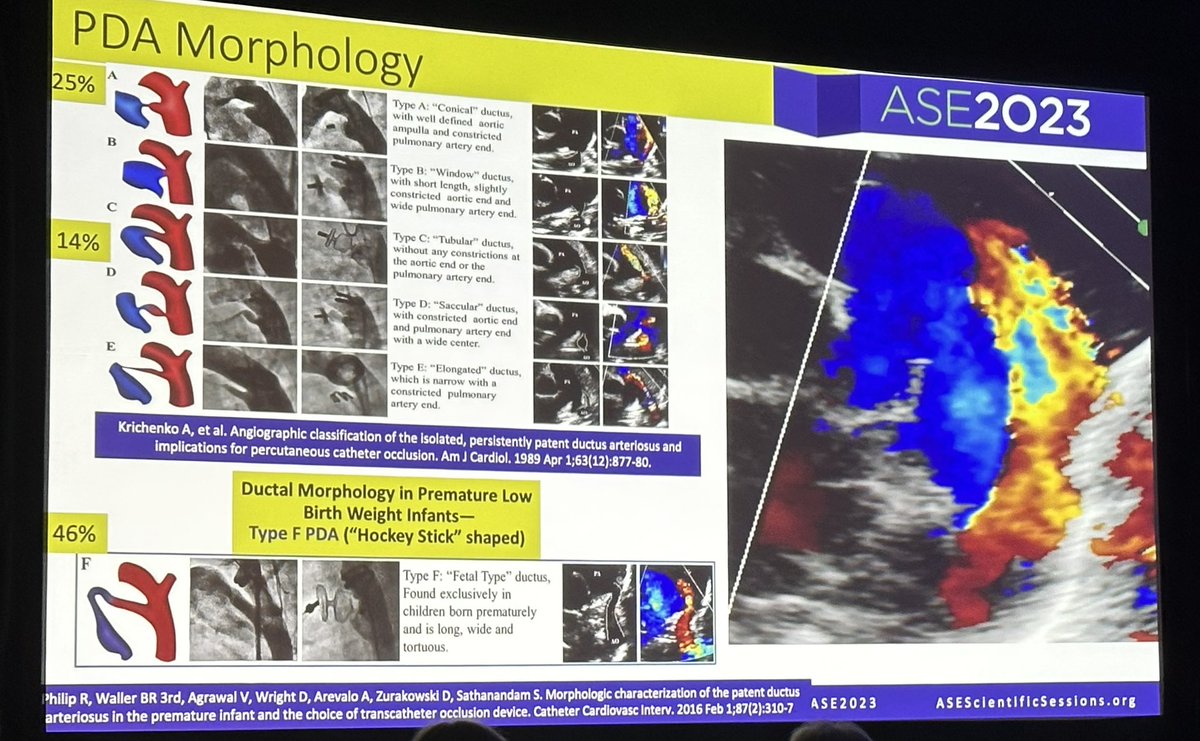 Ummmmm that’s a big PDA! #ASE2023 @ASE360