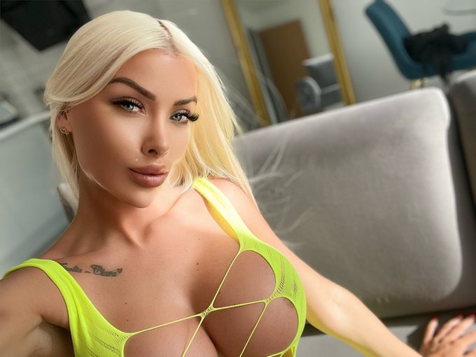 I love my new look thanks to my amazing surgeon&hellip; the surgeons  ask Teela what do you want to look like
