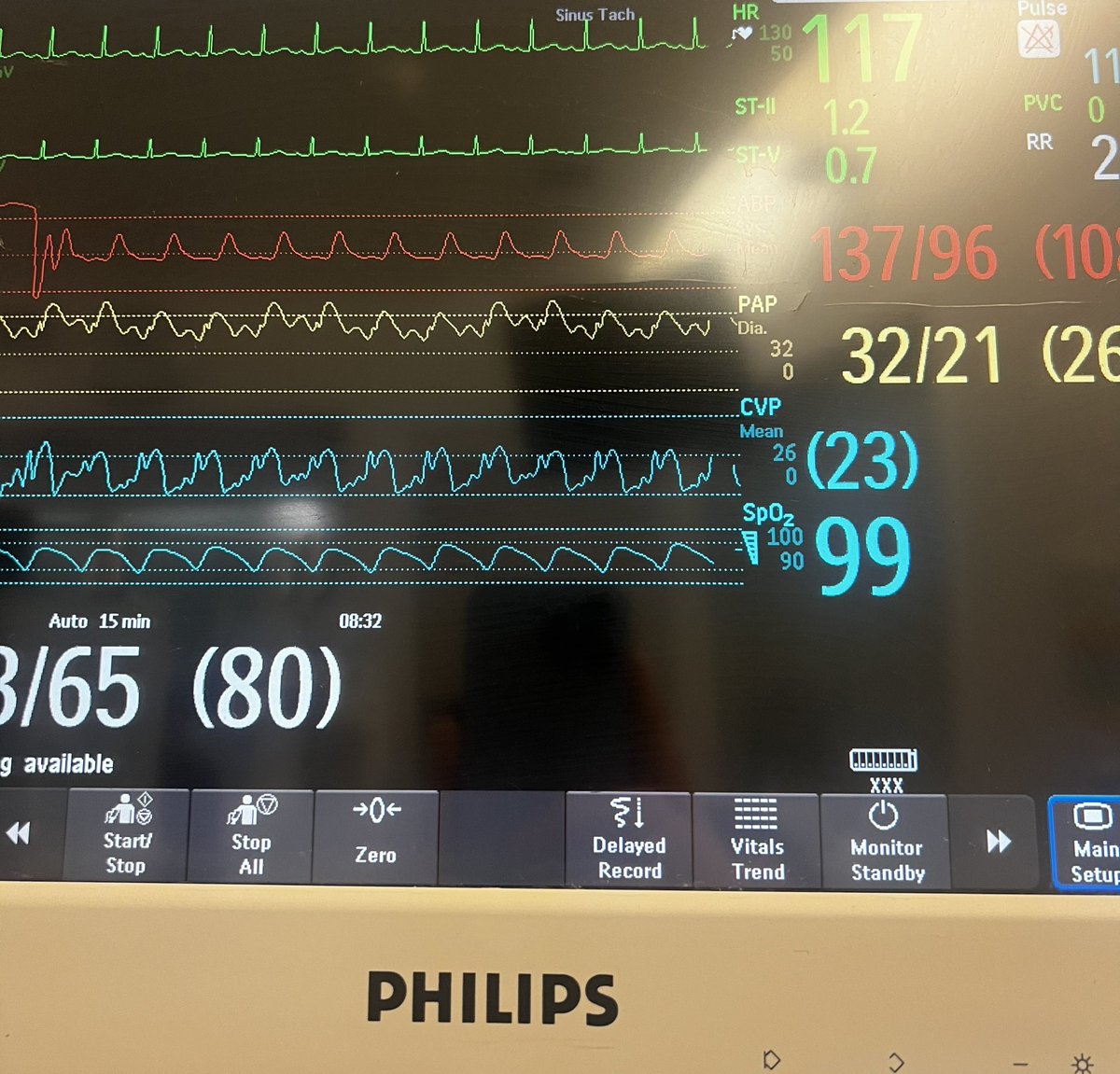 Milad Sharifpour, MD tweet media