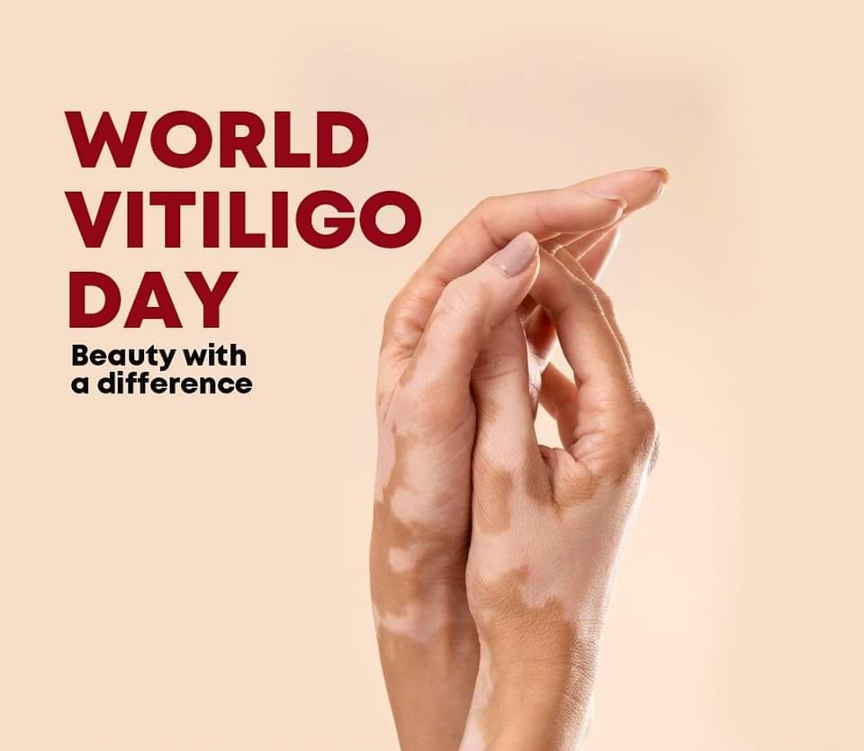 Doctor_C2C's tweet image. "Vitiligo: Looking into the Future".
#Leucoderma
#WorldVitiligoDay
#SkinDisease
#Pride2023
#sundayvibes