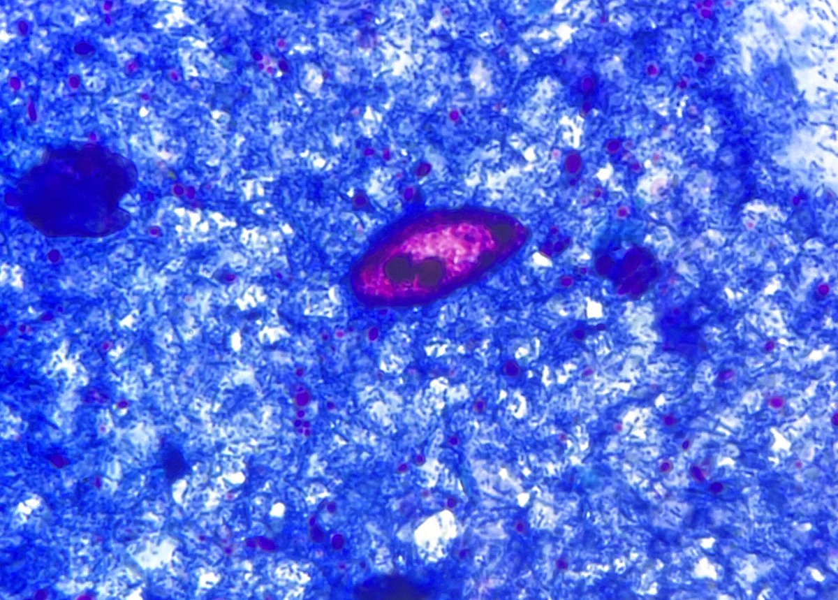 Bobbi Pritt, MD tweet media