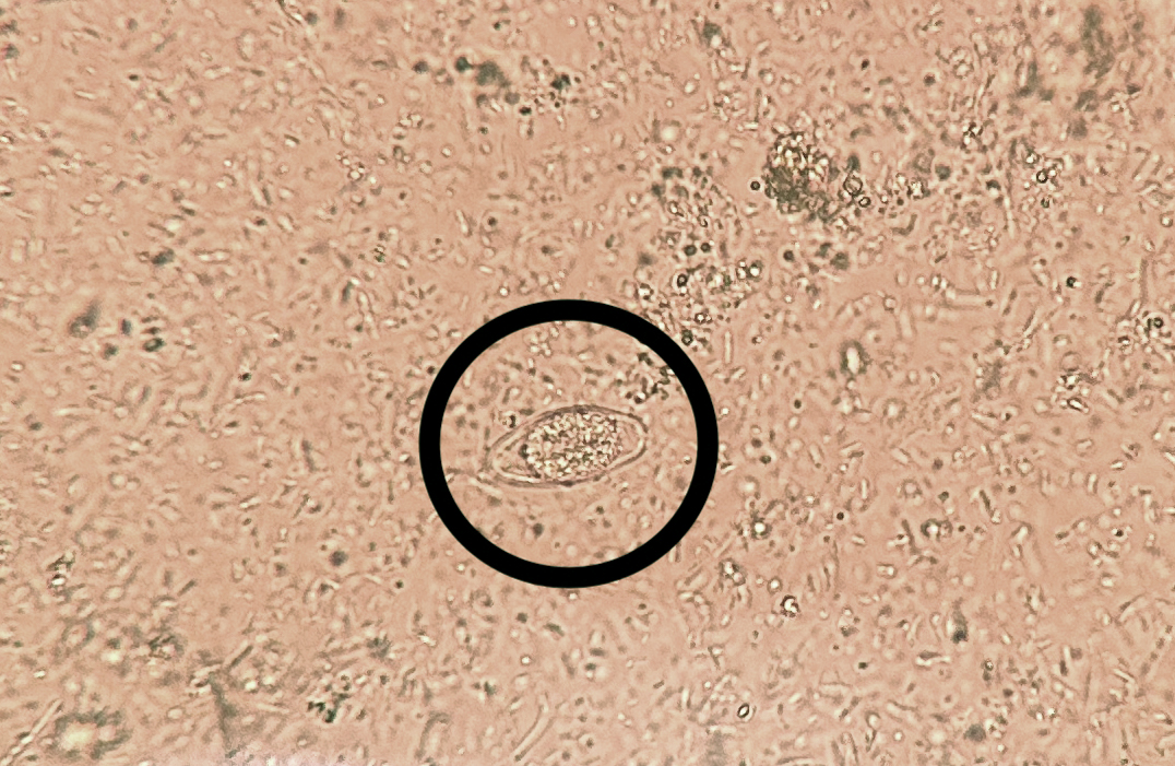 Bobbi Pritt, MD tweet media