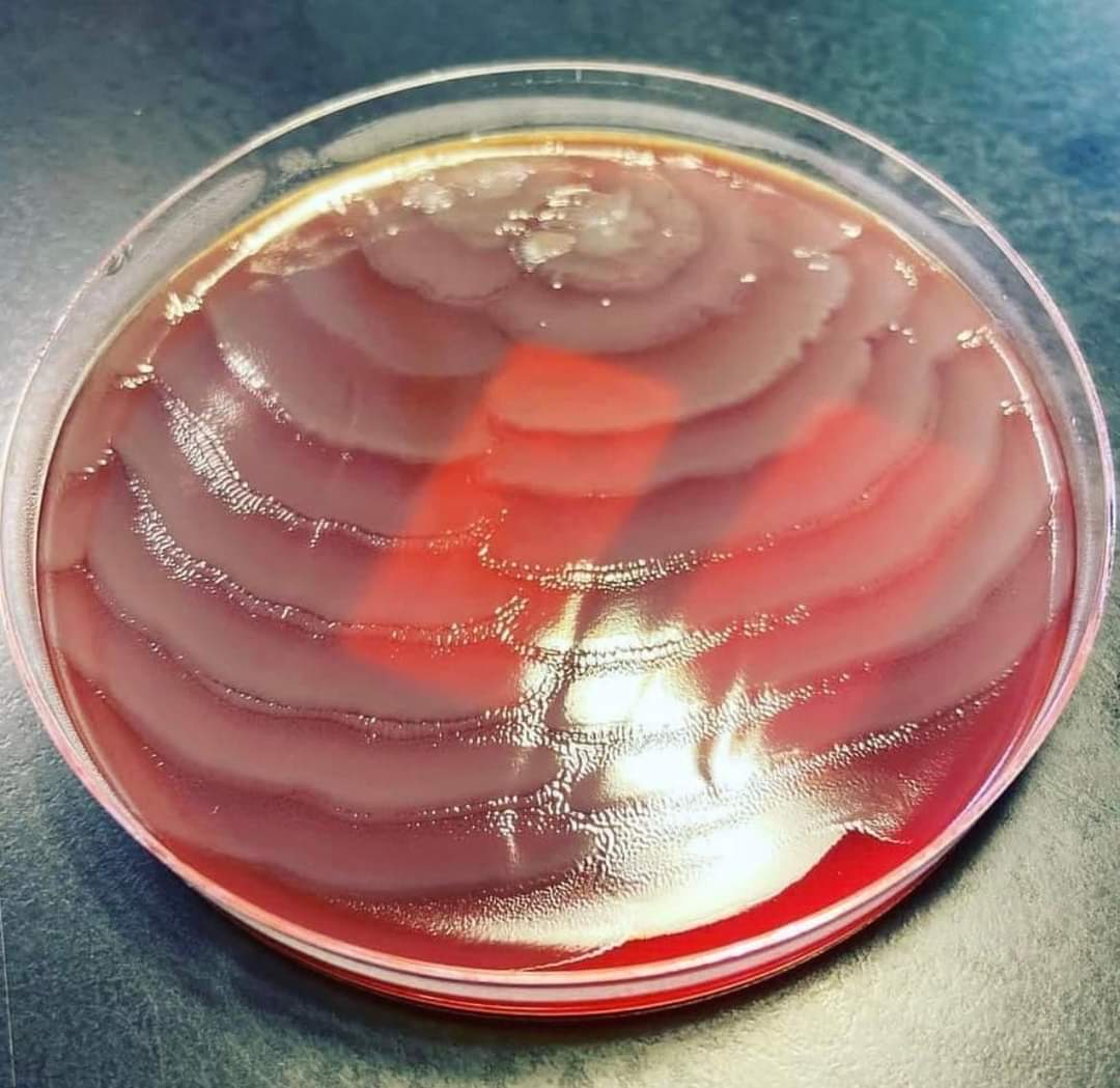 El fenómeno de "swarming" se caracteriza por la formación de círculos concéntricos a partir del punto de inoculación, que le brindan un aspecto de diana a la colonia. 

Lo más sorprendente de este fenómeno ocurre a nivel microscópico, cuando los bacilos, que provienen de un medio