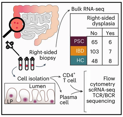 knowing_01's tweet photo. Today's #weeklypublication presents a #multiomics study identifying a distinct immunologic gene signature associated with higher risk &amp; shorter time to #dysplasia in primary sclerosing cholangitis #PSC but not inflammatory bowel disease #IBD patients.

➡️https://t.co/rWXDtjoC01 https://t.co/tpVs66ZTJX
