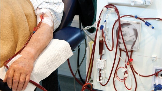 Nephrology19's tweet photo. Continuous #Renal #Replacement #Therapy (CRRT) Market Share, #Trends, Size And #Forecasting to 2032 
Read more: https://t.co/Qi8XZ22MvB
submit your paper on: https://t.co/PErEkqW9ed
#oain
#manuscript
#research
#renal #replacement #therapy
#uk https://t.co/VwtidCIZRI