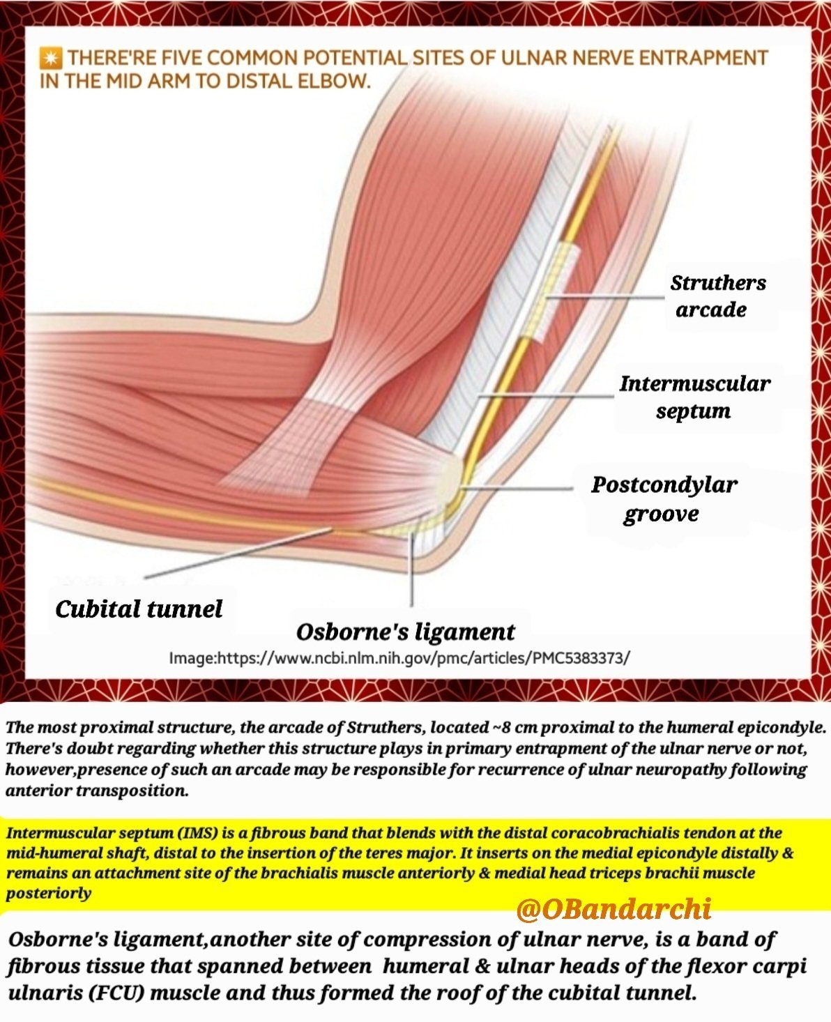 What is Ulnar Nerve Entrapment?