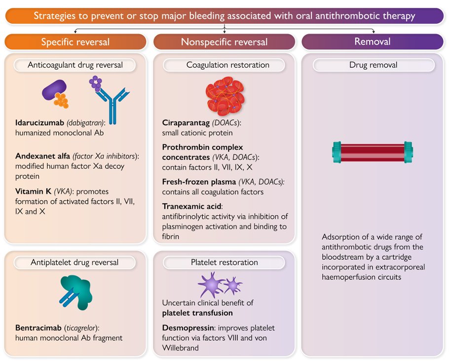 How do you manage patients on oral anticoagulation with active bleeding?

See state of the art review here in EHJ 👇

Reversal and removal of oral antithrombotic drugs in patients with active or perceived imminent bleeding.

doi.org/10.1093/eurhea…

#EHRA_ESC #EHRA_Ecomm #EPeeps