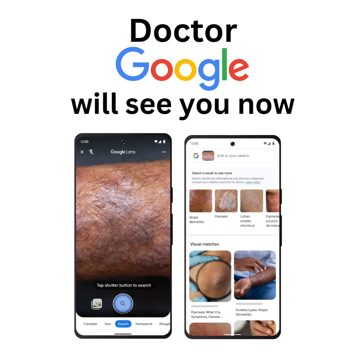 📢👩‍⚕️ THREAD: The rise of 'Doctor Google' 

1/ 'Doctor, I'm worried I might have skin cancer...' 😰

'Oh, really? What makes you think that?'
'I googled it...'

#ai #machinelearning #digitaltransformation #triage #teledermatology #telehealthcare #remotehealthcare