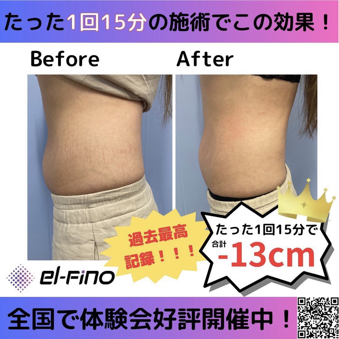 こんにちは✨

サロンオーナー様必見！
話題のエルフィーノ体験会が凄すぎる😳
たったの15分で平均−5.8cm🔥

体験会予約はこちら⬇️
lenard.jp/el-fino/reserv…

Instagramのフォローもよろしくお願いします💓 
instagram.com/p/CtsclbxySzt/…

#企業公式相互フォロー #企業公式春のフォロー祭り #相互フォロー
