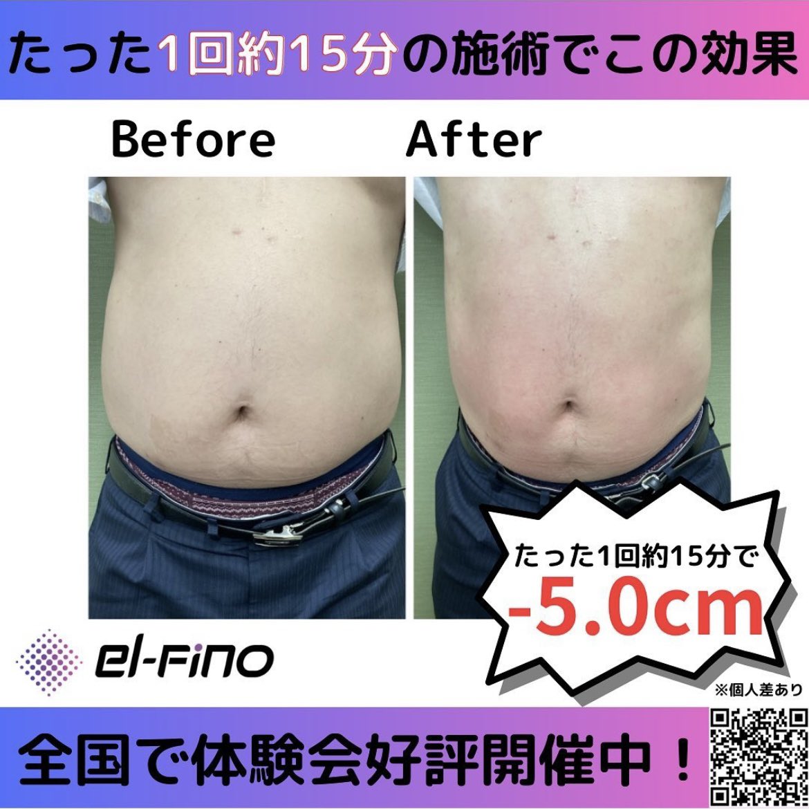 LENARD_JP's tweet photo. こんにちは✨

サロンオーナー様必見！
話題のエルフィーノ体験会が凄すぎる😳
たったの15分で平均−5.8cm🔥

体験会予約はこちら⬇️
https://t.co/CLr7kBX8jW

Instagramのフォローもよろしくお願いします💓 
https://t.co/VAjQ42M90u

#企業公式相互フォロー #企業公式春のフォロー祭り #相互フォロー https://t.co/K7j9DFB0SI