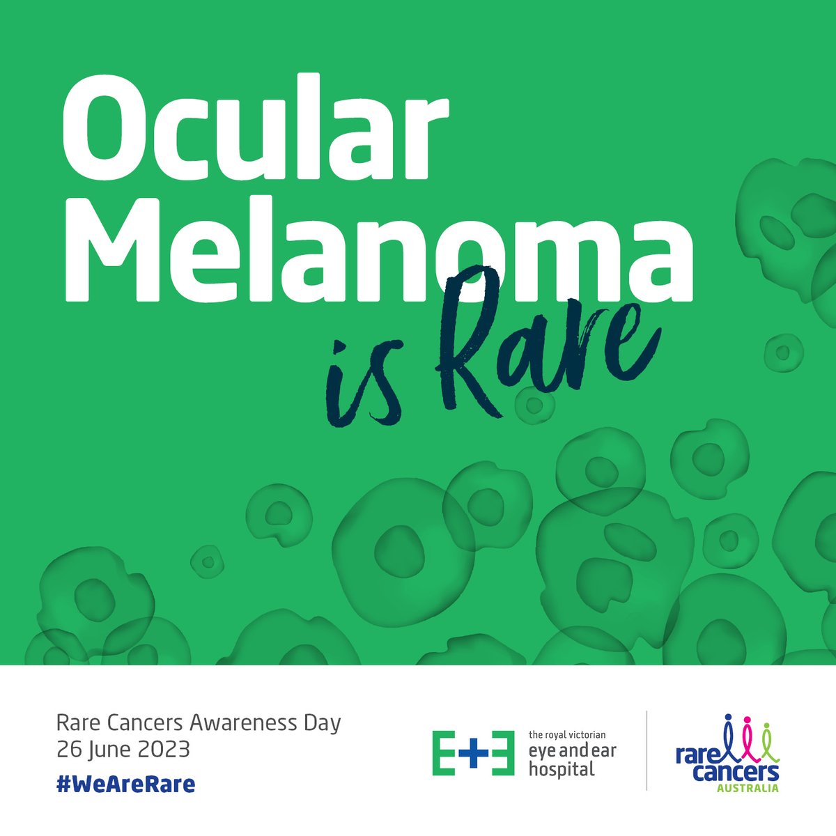 Today we shine a light on #RareCancersAwarenessDay. One rare type of cancer is Ocular Melanoma. Here at the Eye and Ear we have an ocular oncology clinic with highly trained specialists who are dedicated to providing exceptional care.
#WeAreRare #Youareinsafehands