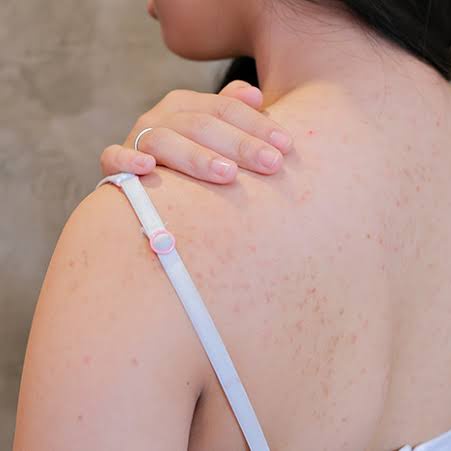 Ini Istrimu tweet media