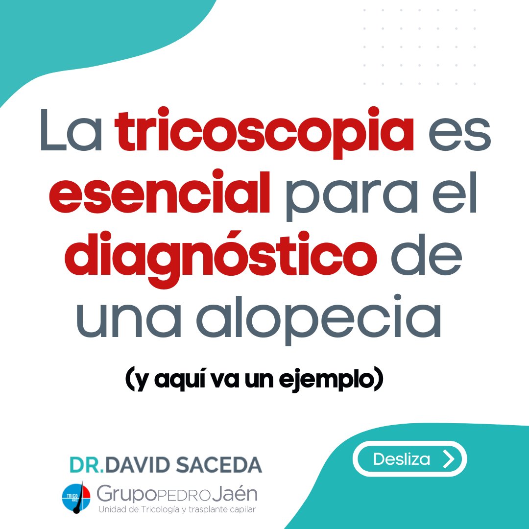 Desaze's tweet photo. Algo indispensable en la consulta de tricología de un dermatólogo es la tricoscopia.🔍 Es una técnica rápida, que no implica molestias y nos aporta muchísima información valiosa sobre el estado del cabello. https://t.co/NfPnFWYQP0