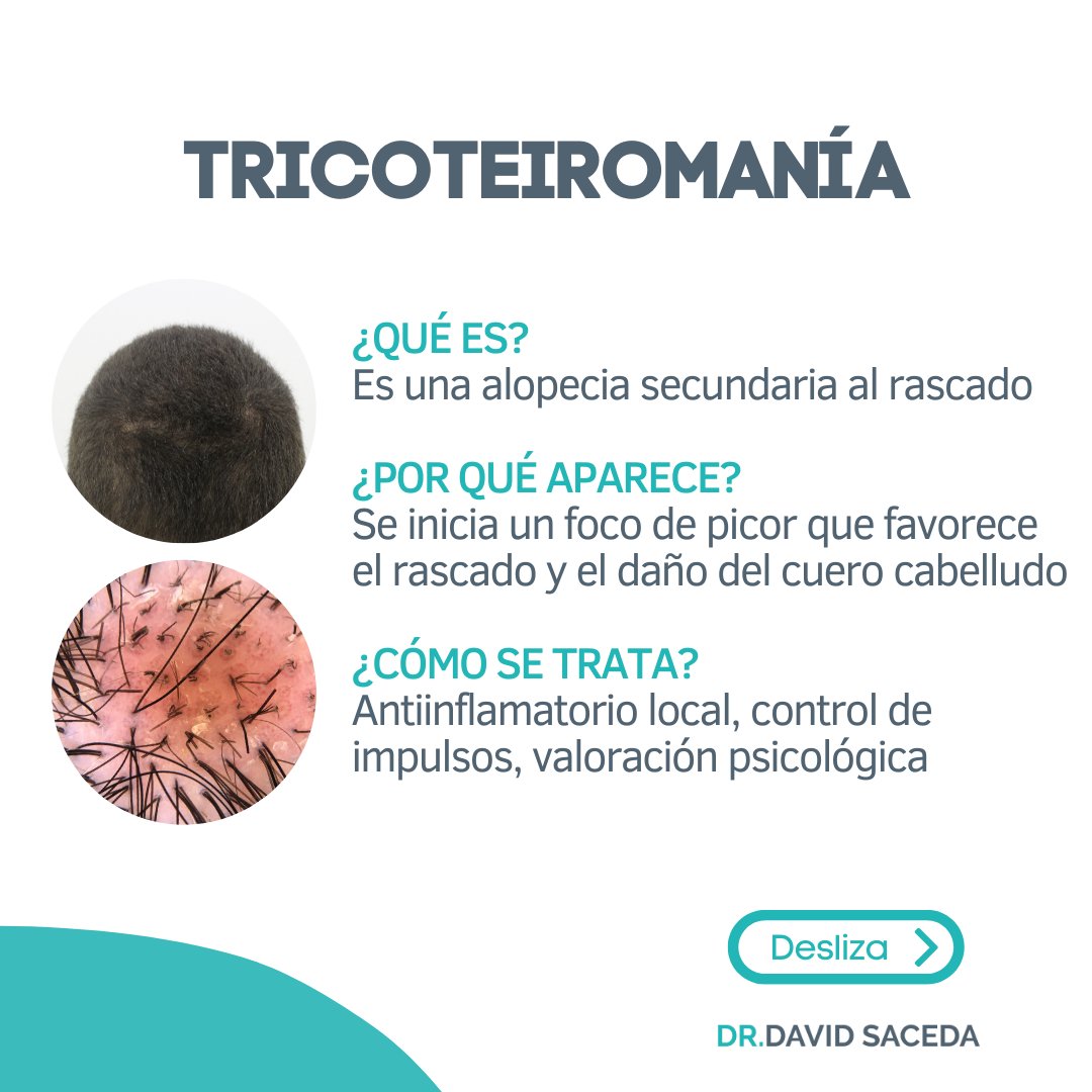 Desaze's tweet photo. Algo indispensable en la consulta de tricología de un dermatólogo es la tricoscopia.🔍 Es una técnica rápida, que no implica molestias y nos aporta muchísima información valiosa sobre el estado del cabello. https://t.co/NfPnFWYQP0