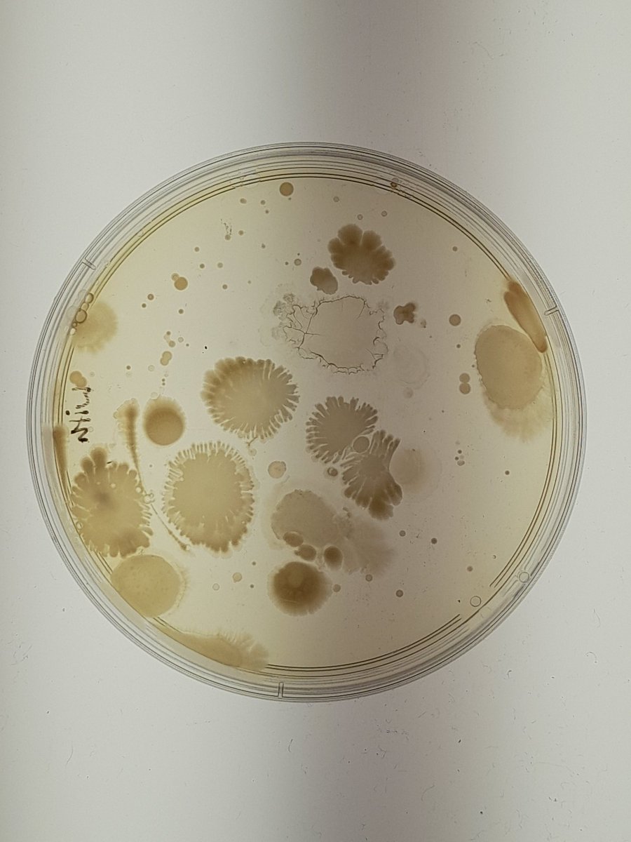 _ASCUS's tweet photo. Some beautiful colony morphologies appearing from microbes in ambient air 🦠🧫

#microbemonday #microbiology #ascuslab https://t.co/lNGyondfnZ