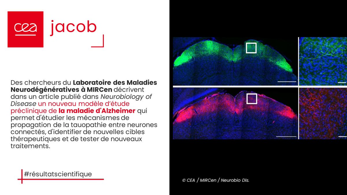 CEA_Jacob_'s tweet photo. [🔬#résultatscientifique] 🧠Des chercheurs du @LMN de #MIRCen décrivent dans le journal 📰Neurobiology of Disease un nouveau modèle préclinique d’#Alzheimer pour étudier la propagation de la tauopathie et identifier de nouvelles cibles thérapeutiques.
ℹ️👉https://t.co/gaNe1Opfm7 https://t.co/uGpykrOQ6B