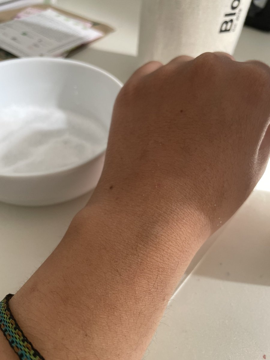 yoligrilla's tweet photo. La gente podrá burlarse lo que quiera del saber ancestral.
Una vez en Tayrona una indígena Wuayúu reaccionó en mi ayuda cuando una abeja me picó la boca. Dijo: rápido, sal. Hoy me picó una avispa 🐝, no una sino dos veces. Antes de la sal / Después. Juzguen ustedes. https://t.co/TfSrMdJze5