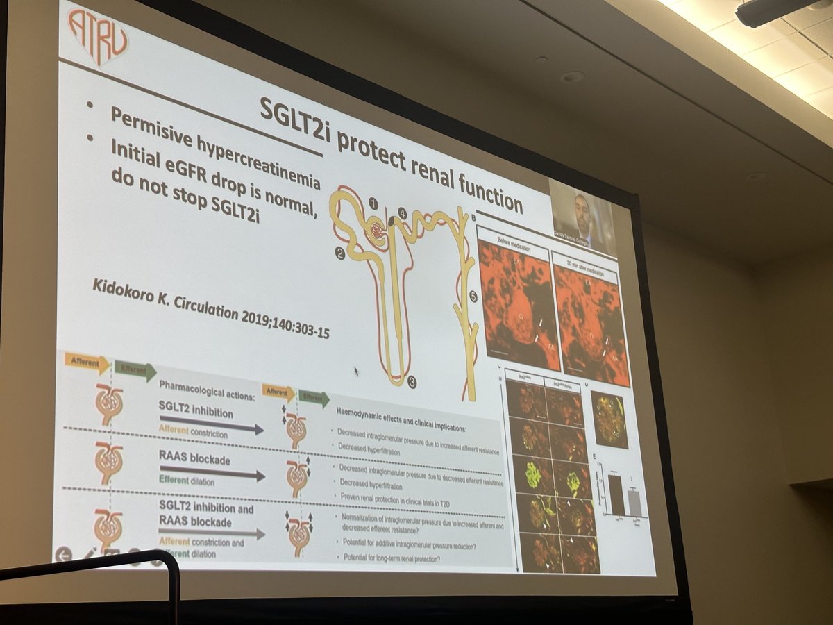 Excellent summary of the renal benefits SGLT2 inhibitors by ⁦@SantosGallegoMD⁩ at #ADA2023 ⁦@JavedButler1⁩ ⁦@hvanspall⁩ ⁦@ajnelson⁩ ⁦@MWilkinsonMD⁩ ⁦@MountSinaiHeart⁩