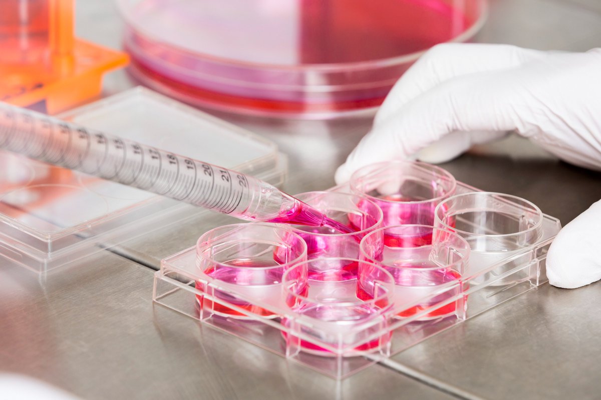 Syncona (@synconaltd) on Twitter photo Today <a href="/FreelineLife/">FreelineLife</a> announced it has dosed its first patient with its novel adeno-associated virus (#AAV) #genetherapy candidate for #Gaucher disease, marking an important step forward for the Gaucher community. Read the full announcement here: synconaltd.com/news-and-insig… Today <a href="/FreelineLife/">FreelineLife</a> announced it has dosed its first patient with its novel adeno-associated virus (#AAV) #genetherapy candidate for #Gaucher disease, marking an important step forward for the Gaucher community. Read the full announcement here: synconaltd.com/news-and-insig…