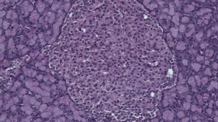 Agência FAPESP (@agenciafapesp) on Twitter photo #Hormônio do tecido adiposo protege células que secretam #insulina e reverte danos da #obesidade. A descoberta, feita por pesquisadores do <a href="/LabMetabolism/">Energy Metabolism Lab</a> <a href="/iq_usp/">IQUSP</a> e publicada em <a href="/Aging_Cell/">Aging_Cell</a>, faz a molécula despontar como potencial alvo terapêutico. agencia.fapesp.br/41727/ #Hormônio do tecido adiposo protege células que secretam #insulina e reverte danos da #obesidade. A descoberta, feita por pesquisadores do <a href="/LabMetabolism/">Energy Metabolism Lab</a> <a href="/iq_usp/">IQUSP</a> e publicada em <a href="/Aging_Cell/">Aging_Cell</a>, faz a molécula despontar como potencial alvo terapêutico. agencia.fapesp.br/41727/