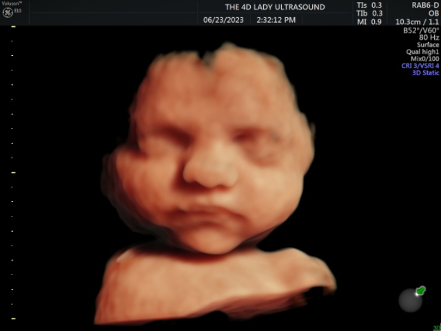 Can we just all take a moment to appreciate how far technology has come in the ultrasound world? This is a 28 week old baby in HD imaging and you can literally see her entire face and every perfect detail! THIS IS INCREDIBLE!