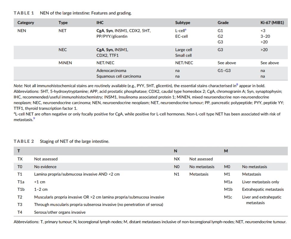 📌 European Neuroendocrine Tumor Society (#ENETS) 2023
guidance paper for #colorectal #neuroendocrine tumours.

👉🔗🆓 t.ly/vNw4
@JNE_Editor
 
#EndoTwitter
#MedTwitter