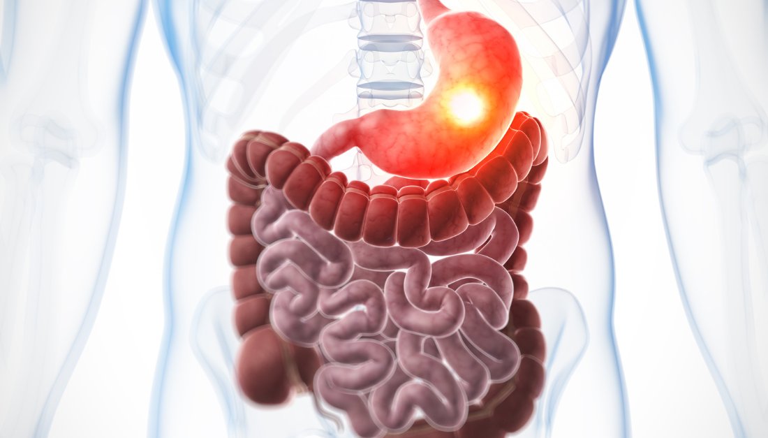 #GastricCancer Biomarker Candidates Identified by #MachineLearning and Integrative #Bioinformatics: Toward #PersonalizedMedicine

Study reveals novel potential diagnostic biomarker candidates for gastric cancer through integrated bioinformatics approaches: ow.ly/SZIo50OXbKh