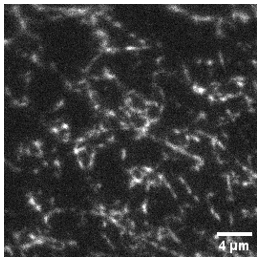 Lydia Kisley (@lydia_kisley) on Twitter photo #ImageOfTheWeek from the lab - very interesting images of collagen fibrils formed over time in some initial collaborative experiments w/<a href="/SvetaMoro/">Sveta Morozova</a>'s lab. I feel lucky when the first time a sample is put on the microscope & you see "something"! Led by Surajit and Kathryn #ImageOfTheWeek from the lab - very interesting images of collagen fibrils formed over time in some initial collaborative experiments w/<a href="/SvetaMoro/">Sveta Morozova</a>'s lab. I feel lucky when the first time a sample is put on the microscope & you see "something"! Led by Surajit and Kathryn