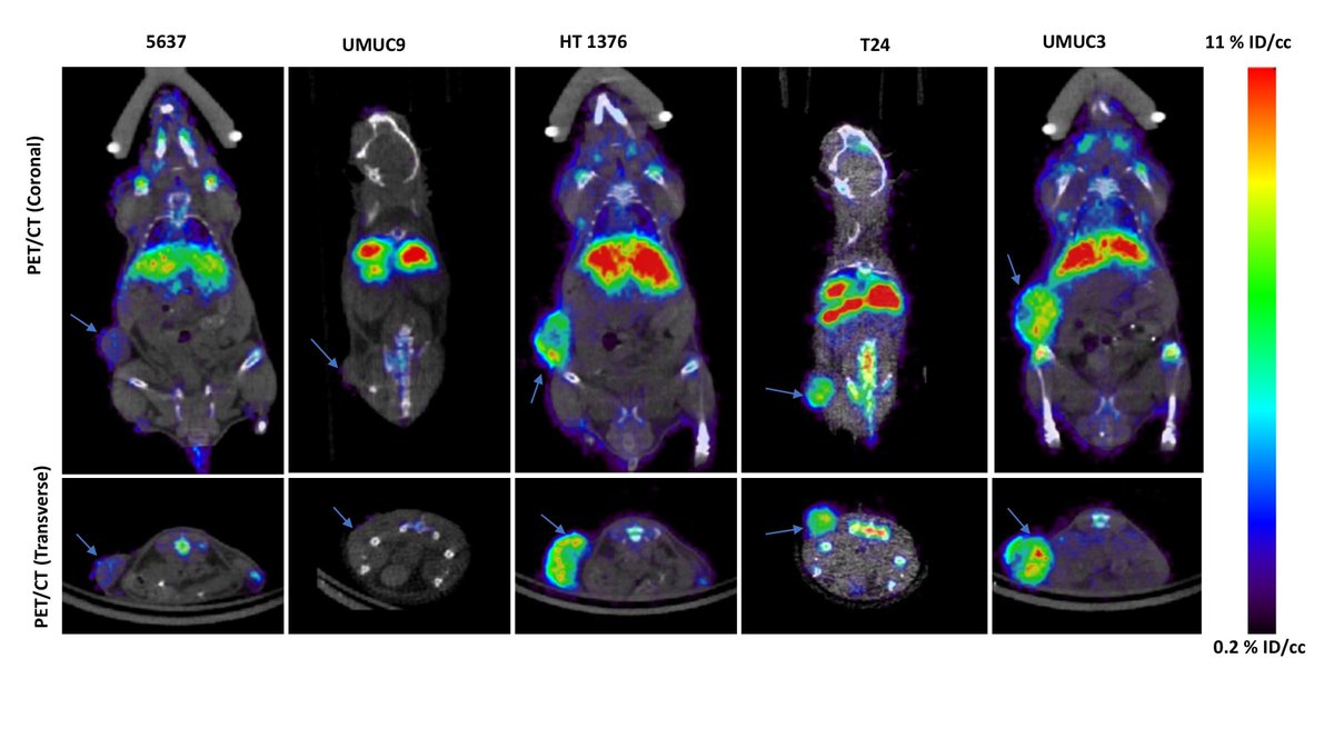 #SNMMI23 Abstract Highlight: New radiopharmaceutical therapy target identified for metastatic #BladderCancer. ow.ly/hpVI50OWB8v #NuclearMedicine #RPTherapy