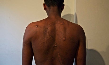 On the Int'l Day in Support of Victims of Torture, we remember the 1000s of 🇪🇷ns reportedly tortured by the #IsiyasRegime. We continue to seek accountability for the regime's atrocities in #Dankalia. Crimes against humanity can’t remain unpunished. #InternationalDayAgainstTorture