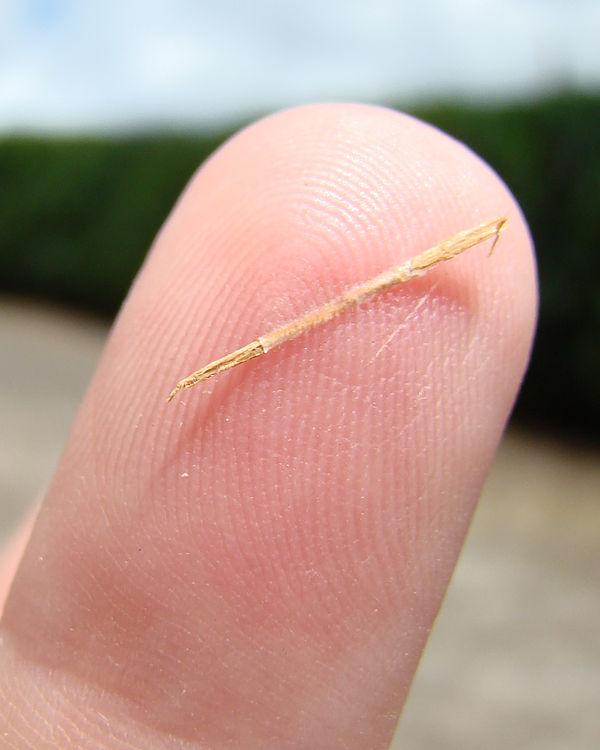 CatholicChats's tweet photo. Splinter or log? Either way there's going to be some pain.... 
https://t.co/mTgfaJJbM7 https://t.co/RJIlbFr0j9