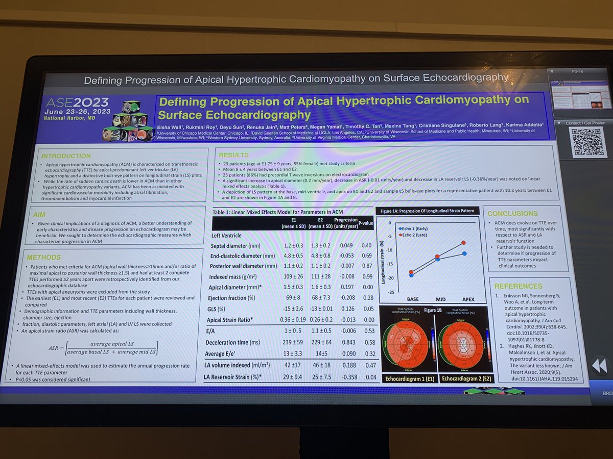 Renu (@renujain19) on Twitter photo Apical HCM does evolve over time on TTE. Apical strain ratio and LA reservoir strain associated with echo progression. <a href="/wali_e/">Eisha Wali</a> <a href="/AddK007/">Karima Addetia</a> <a href="/robertomlang/">Roberto M Lang</a> @MattPetersMD <a href="/PatrycjaGalazka/">Patrycja Galazka</a> <a href="/AuroraCVFellows/">Aurora Cardiovascular Disease Fellowship</a> #ASE2023 <a href="/ASE360/">American Society of Echocardiography</a> Apical HCM does evolve over time on TTE. Apical strain ratio and LA reservoir strain associated with echo progression. <a href="/wali_e/">Eisha Wali</a> <a href="/AddK007/">Karima Addetia</a> <a href="/robertomlang/">Roberto M Lang</a> @MattPetersMD <a href="/PatrycjaGalazka/">Patrycja Galazka</a> <a href="/AuroraCVFellows/">Aurora Cardiovascular Disease Fellowship</a> #ASE2023 <a href="/ASE360/">American Society of Echocardiography</a>
