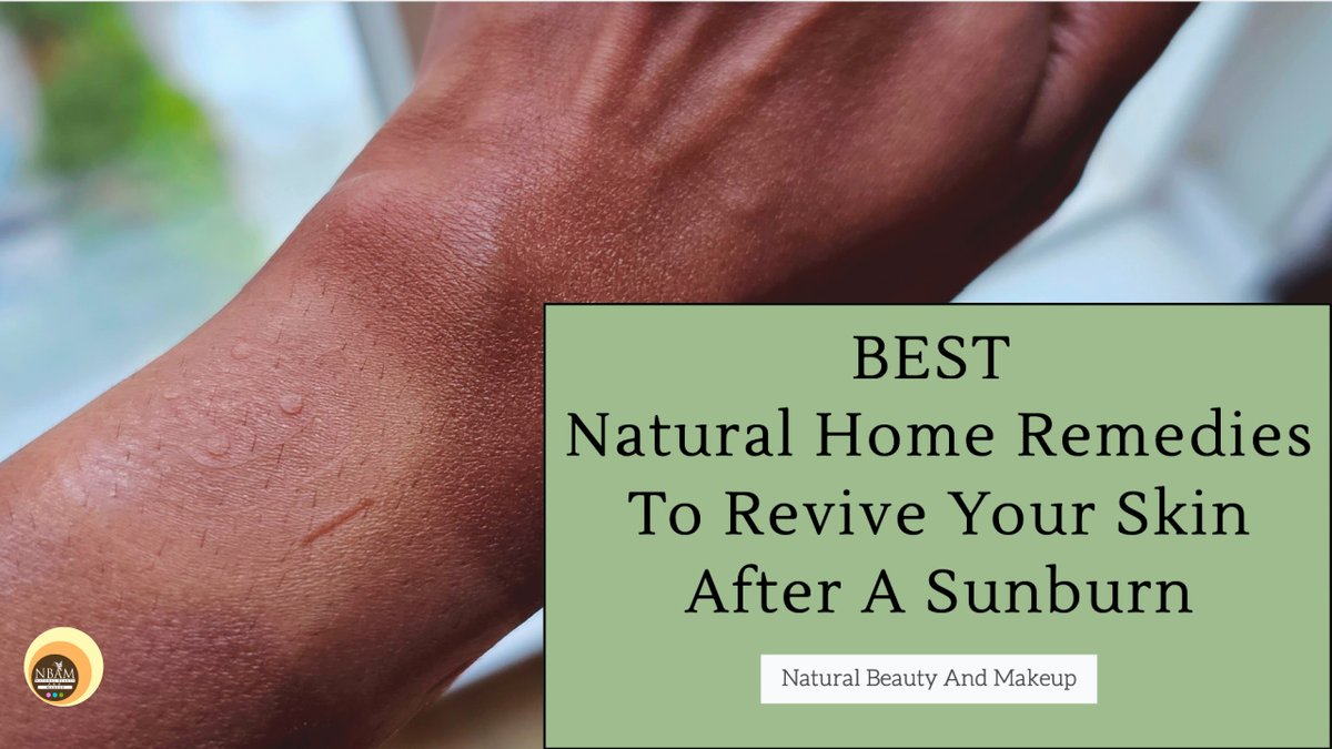 #newpost ✍🏻 Best Natural Home Remedies To Revive Your Skin After A Sunburn is up on the blog #naturalbeautyandmakeup 🙂⬇️

naturalbeautyandmakeup.com/2023/06/best-n…

#sunburn #sunburnrelief #sunburnhomeremedies #naturalremedies #naturalskincareblog  #homeremedies