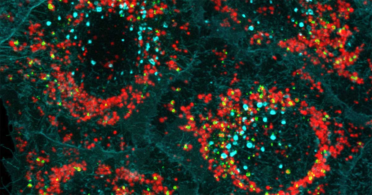 The research, supported by @ASAP_Research, @MichaelJFoxOrg & @mito911_, reveals #Optineurin's role in our body's 'garbage disposal' system. The findings were driven by @ThanhNguyen_TN, @LazarouLab, @martens_sascha & Justyna Sawa-Makarska. #TBK1 #mitophagy #research #science 🧵2/2