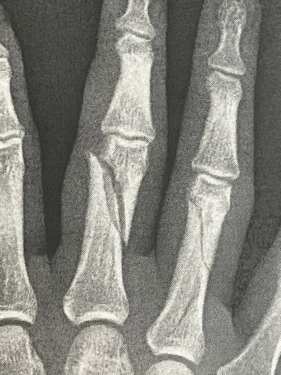 YAꓘKER Wiffleball tweet media