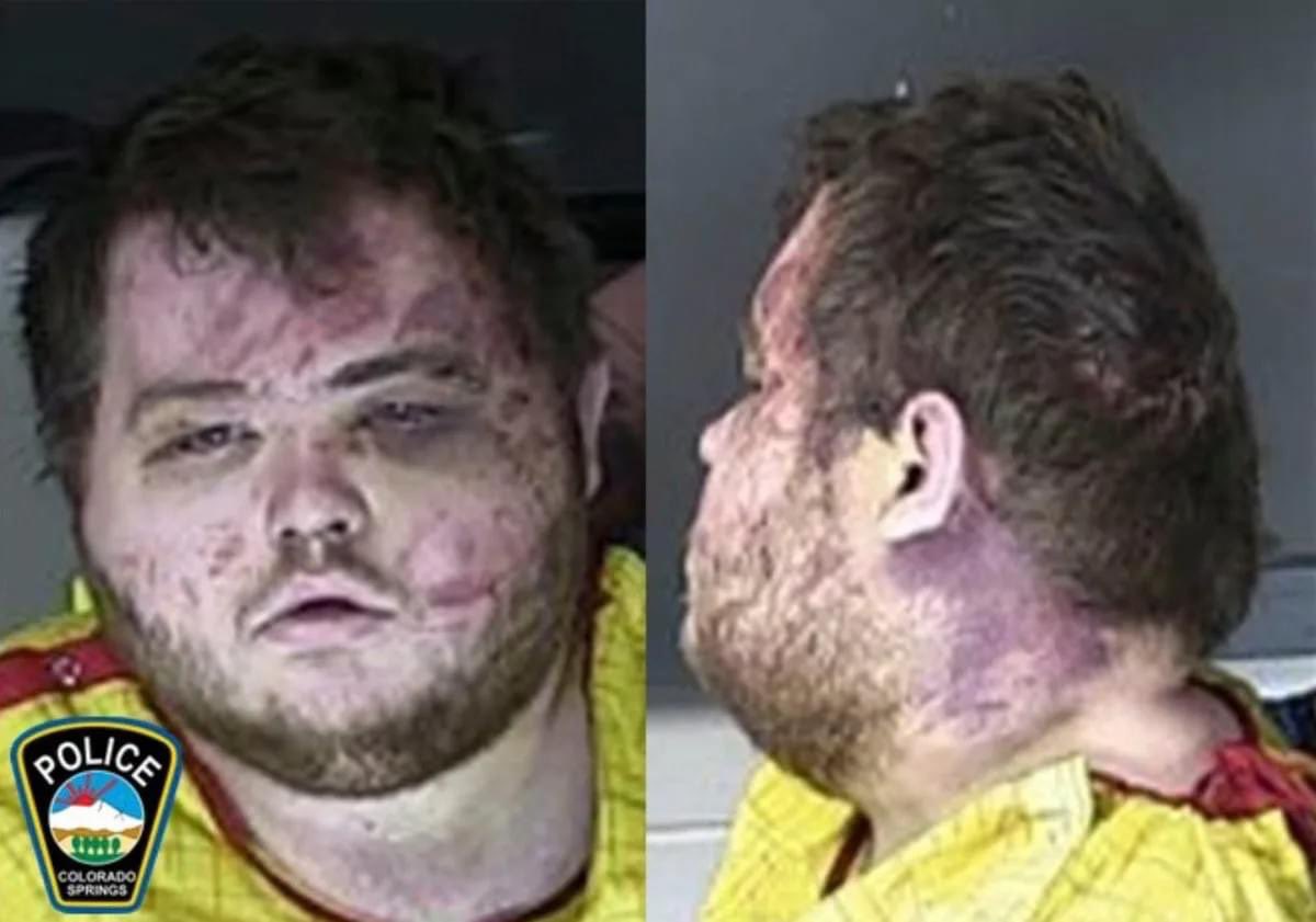 Colorado LGBTQ+ nightclub shooting suspect pleads guilty to 5 counts of murder & 46 counts of attempted murder in the first degree

This equals to over 2,000 + years in prison

#colorado #LGBTQ #breaking #news #breakingnews