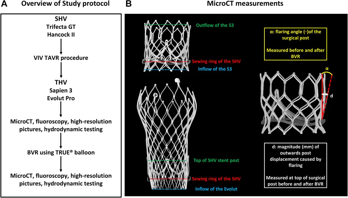 Just out @JACCJournals #JACCINT BVR in non-fracturable SAV (Hancock, Trifecta) increase S3 outflow but pinwheeling remains, no diff in hydrodynamic performance. Great work again by @J_Sathananthan et al. @akcmahi @djc795 @OKhaliqueMD @JoaoLCavalcante jacc.org/doi/full/10.10…